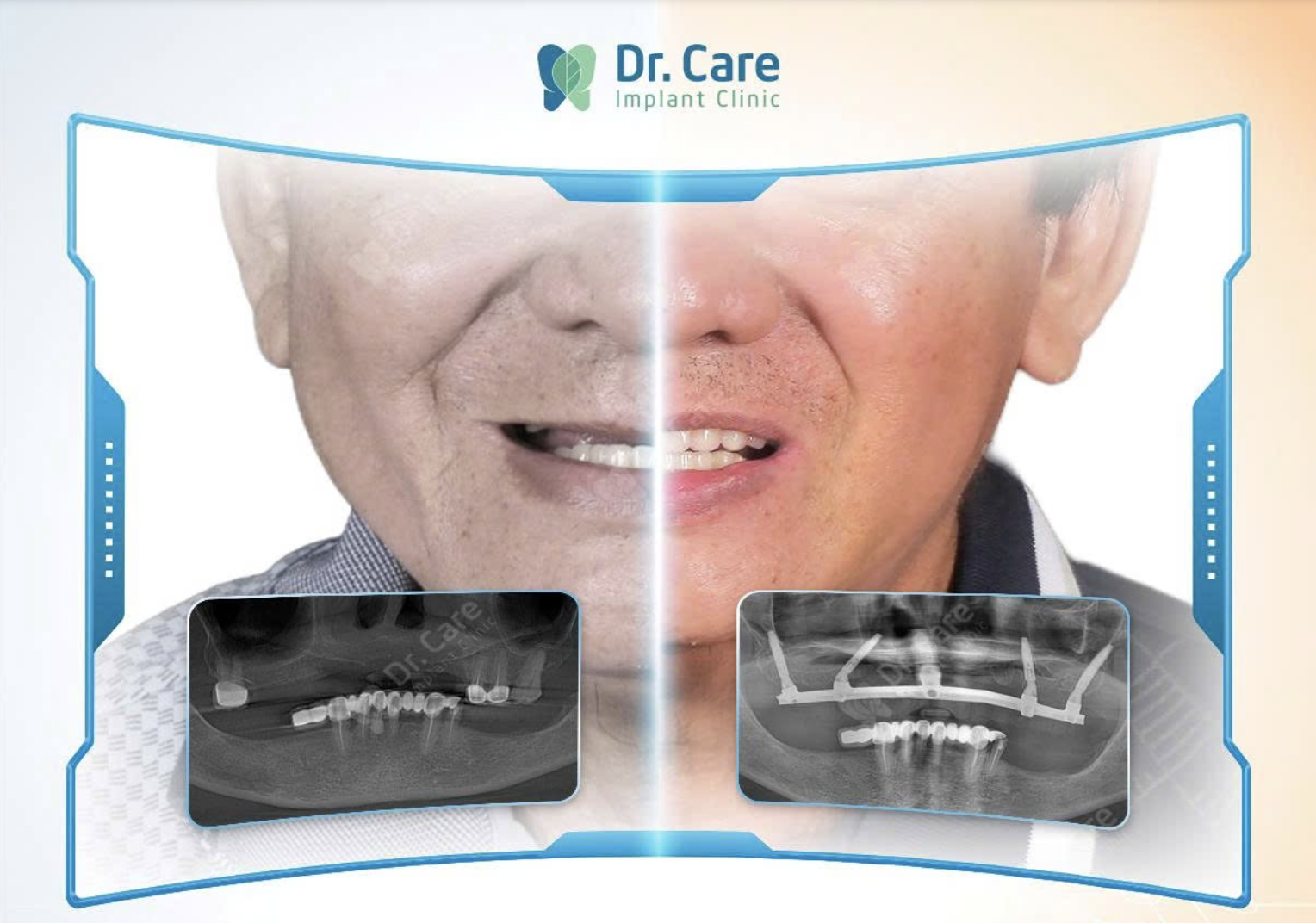Kết quả điều trị thực tế tại Dr. Care