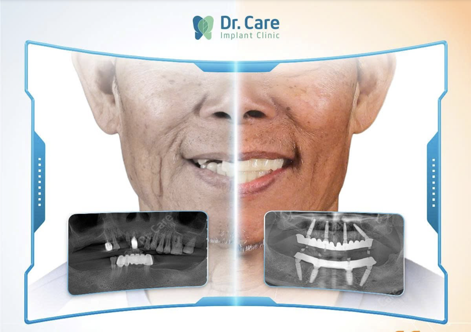 Kết quả điều trị thực tế tại Dr. Care